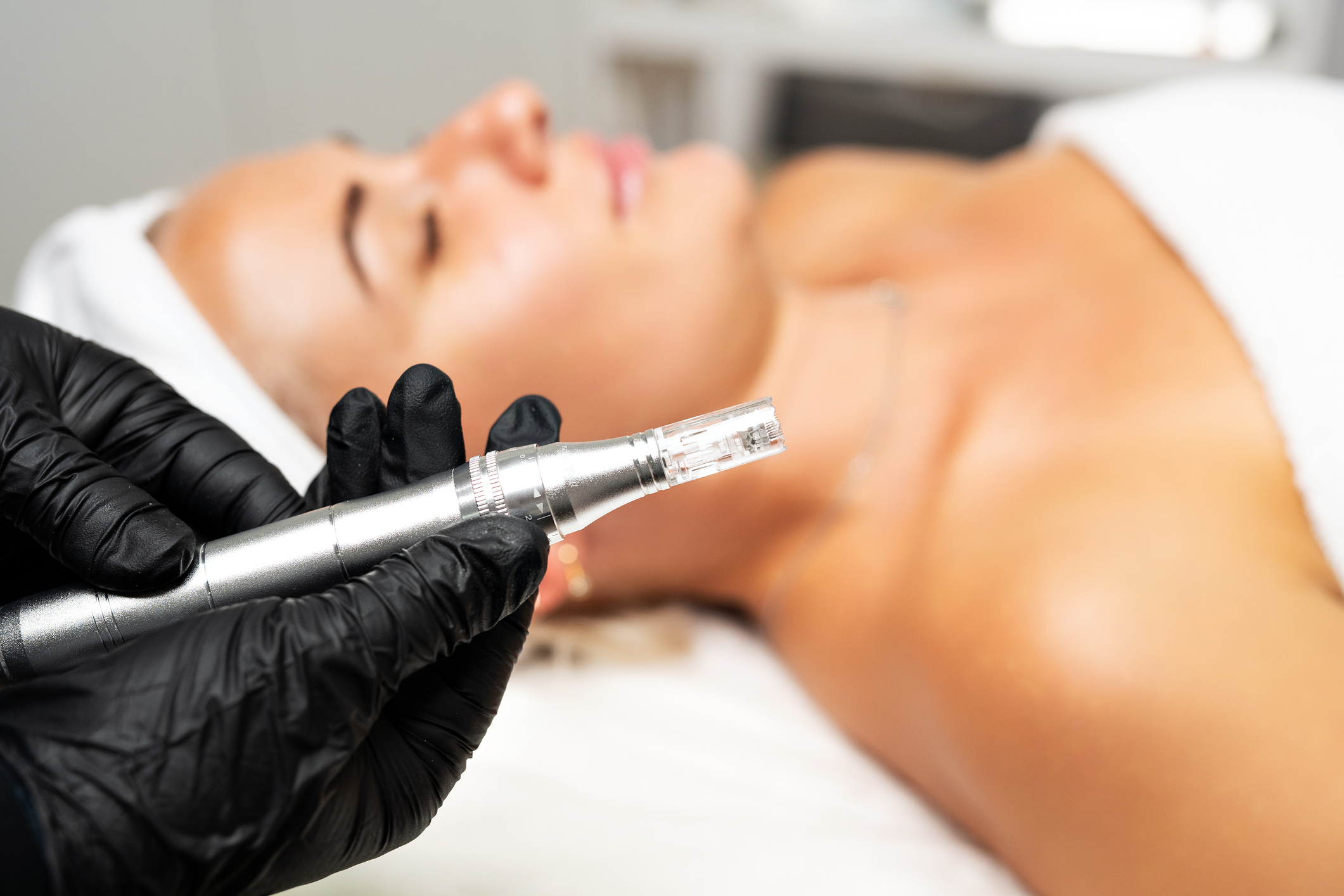 Microneedling Services